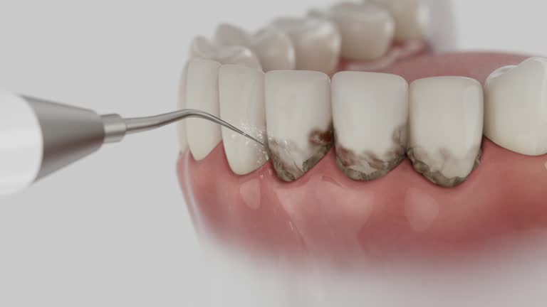 Reliable Dental contractor in Audubon Park, NJ by Dentist Open Now